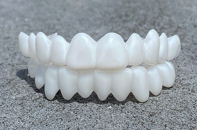 Όψεις Οδόντων DentAlign – Φυσική Εφαρμογή και Άνεση