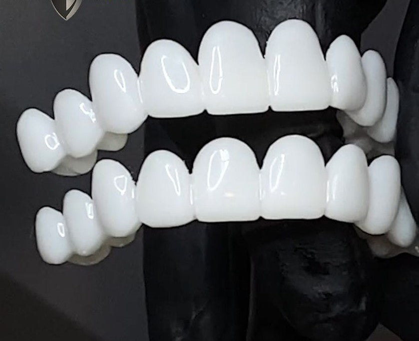 Όψεις Οδόντων DentAlign – Φυσική Εφαρμογή και Άνεση