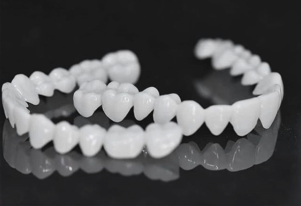 Όψεις Οδόντων DentAlign – Φυσική Εφαρμογή και Άνεση